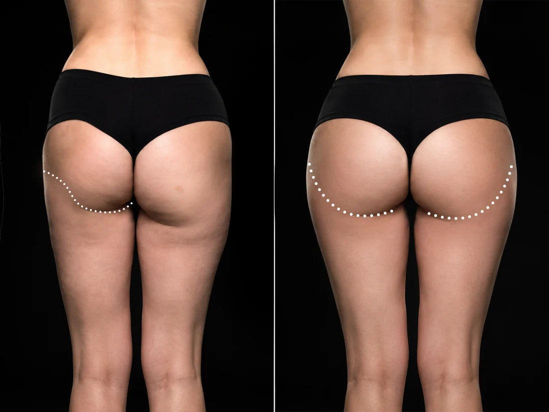 Uneven before and after